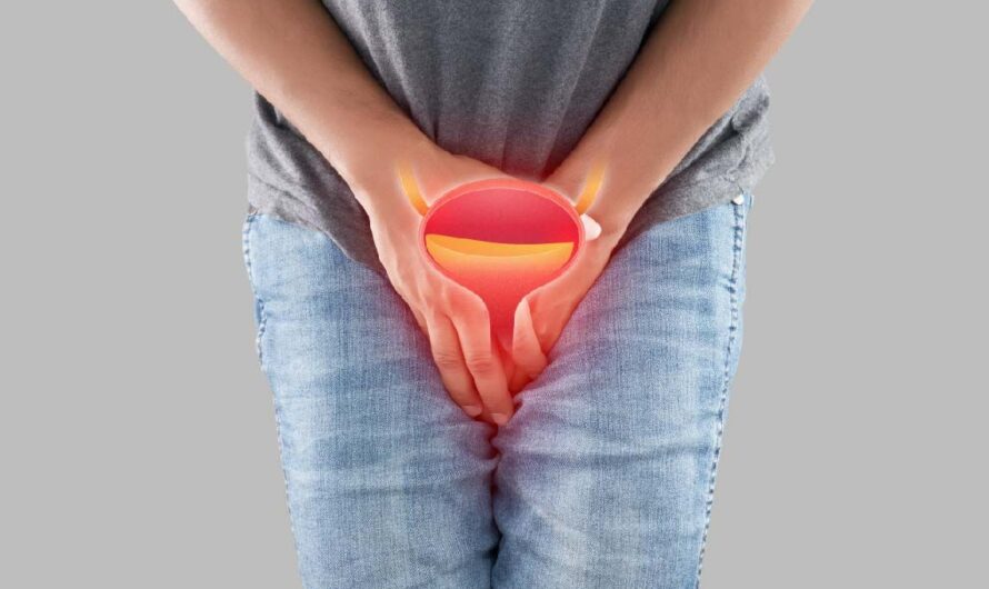 Life-Saving Clues: How to Spot Early Signs of Bladder Cancer in Canada!
